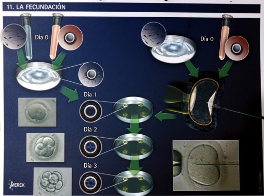 Aumenta el número de casos de infertilidad en Honduras