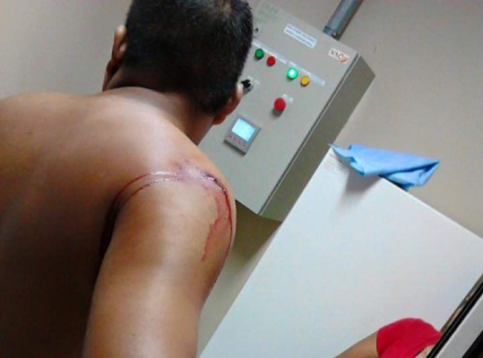 Sobrevive a dantesca masacre en terminal de buses de la López Arellano