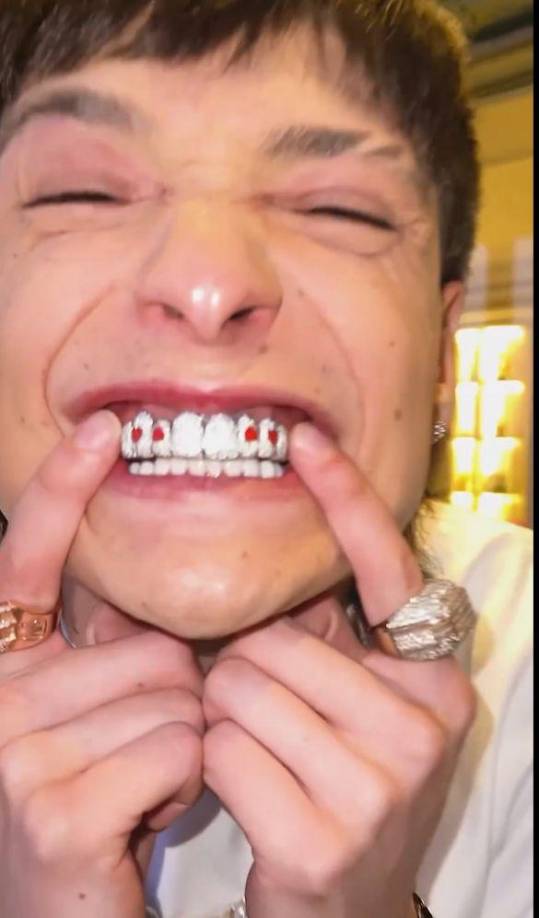 Desde la cuenta oficial de la joyería compartieron una serie de imágenes de Peso Pluma en donde luce una sonrisa millonaria gracias a la dentadura postiza que le realizaron de manera exclusiva. 