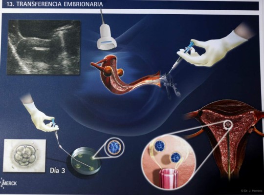 Aumenta el número de casos de infertilidad en Honduras