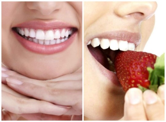 Como blanquearse los dientes de manera fácil, natural y efectiva