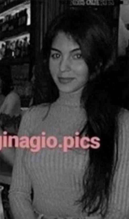 Los cambios en el rostro de Georgina Rodríguez son evidentes.