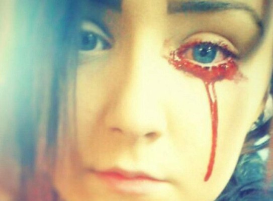 La joven que sangra por los ojos conmociona al Reino Unido