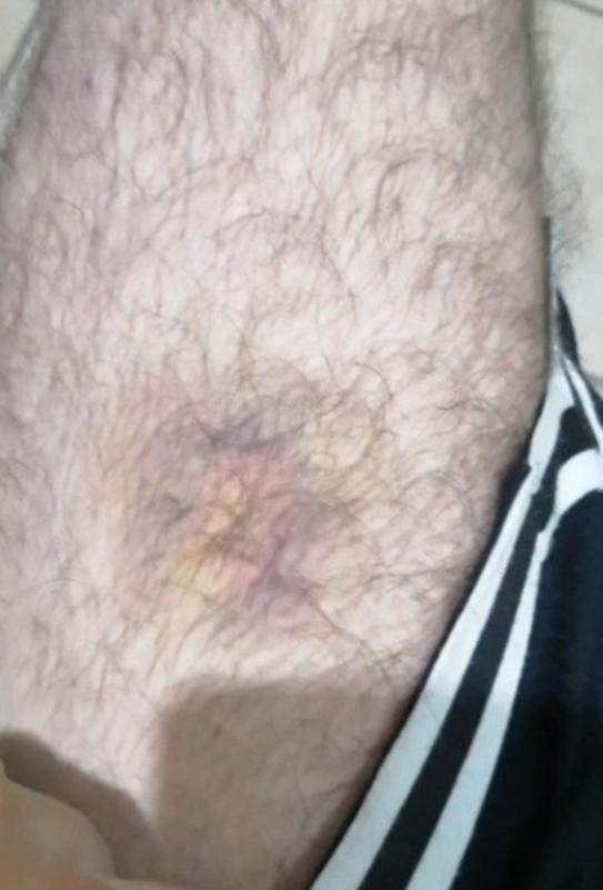 Dan paliza a Gilbert Reyes, ‘Pescado’ Bonilla y Chepito Handal en la cárcel