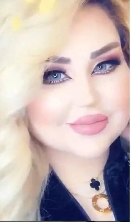 Así era antes de las 43 cirugías de Dalia.