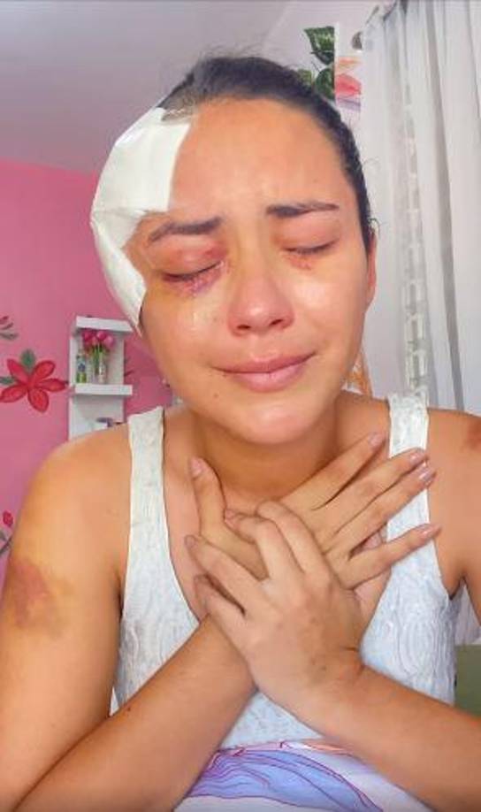 Entre lágrimas, Iris Portillo dijo que el accidente que sufrió “no es para estar contándolo ahorita”, haciendo referencia a que pudo haber muerto.“Dios me guardó, nunca me imaginé que me iba a sucede algo así, pero, yo venía super cansada (...) el sueño me ganó, fue en segundos que sucedió”, dijo la modelo.