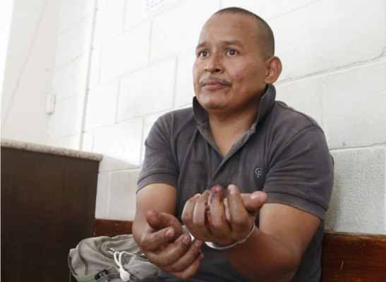 Hombre mata a un homosexual porque este 'lo atacó a mordidas'