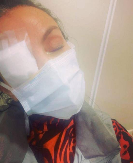 Ivonne Montero pierde la vista tras quemarse las córneas
