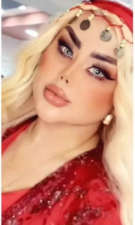 Se ha modificado todo su cuerpo, se ha rellenado los labios, se ha puesto implantes de senos y glúteos, además de aplicarse botox.