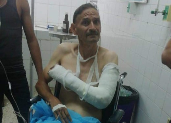 Atacan a balazos a padre e hijo en Olanchito, Yoro