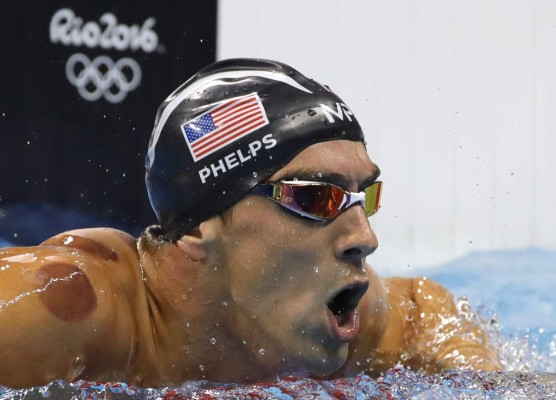 ¿Qué son los circulos rojos de Phelps y otros atletas en Río?