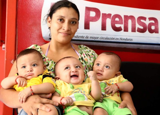 Así lucen los trillizos nacidos en Santa Cruz cinco meses después