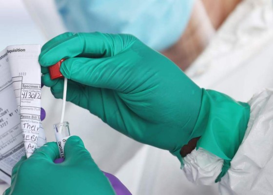 OMS anuncia reanudación de ensayos clínicos con hidroxicloroquina contra coronavirus