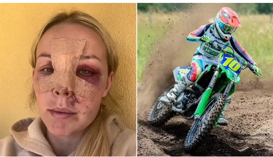 Asimismo agregó: “Todavía tenemos que descubrir qué me cortó la cara, ya que aún se desconoce. Esta es toda la información que pudimos recopilar de lo que sabemos, ya que no recuerdo nada y nadie vio mucho de eso”.