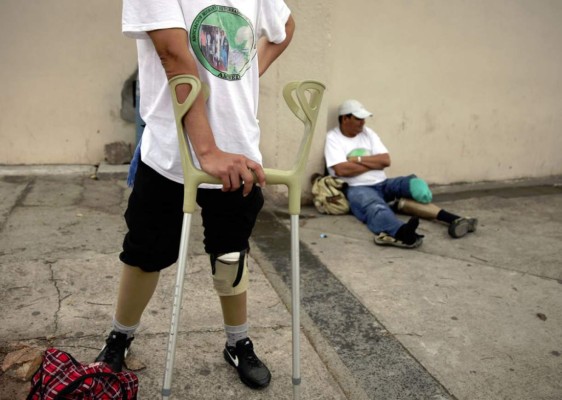 Hondureños mutilados buscan cruzar el Río Bravo