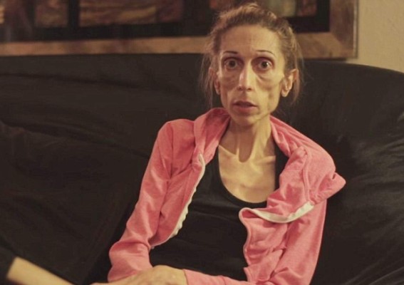 Actriz que sufre anorexia pide ayuda en Internet para salvar su vida