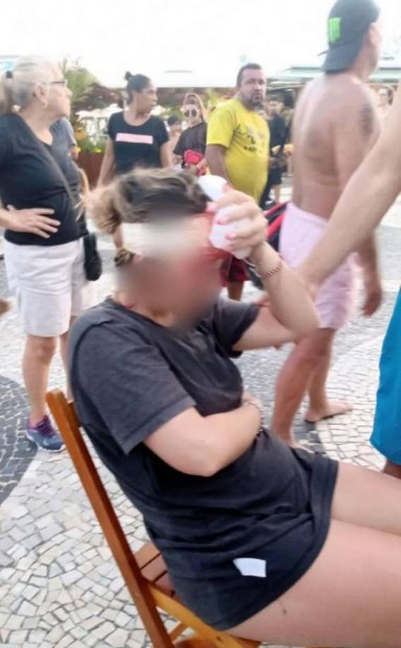 Una aficionada de Boca Juniors recibió varios puntos de sutura en la cabeza tras el ataque de los hinchas del Fluminense.