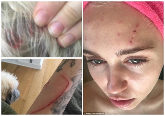 Atacan a Miley Cyrus y ella publica las fotos