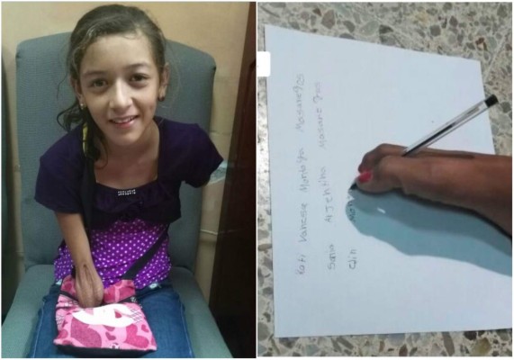 Niña hondureña pide apoyo tras perder sus manos por descarga eléctrica