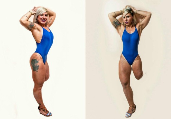 Miss Bumbum tiene su primera candidata discapacitada  