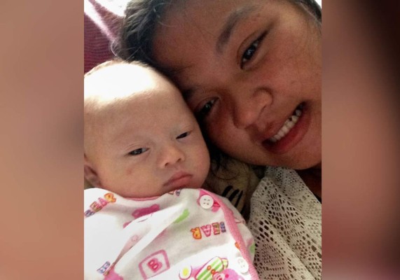 Pareja abandona a gemelo con síndrome de Down