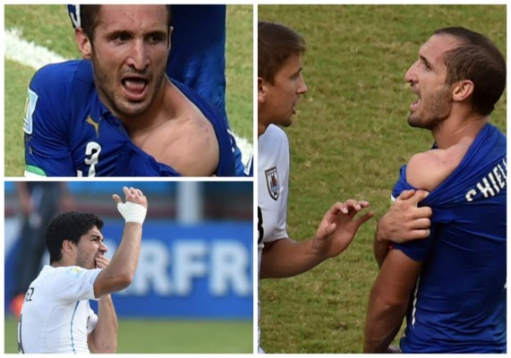 La Fifa investiga presunto mordisco de Luis Suárez