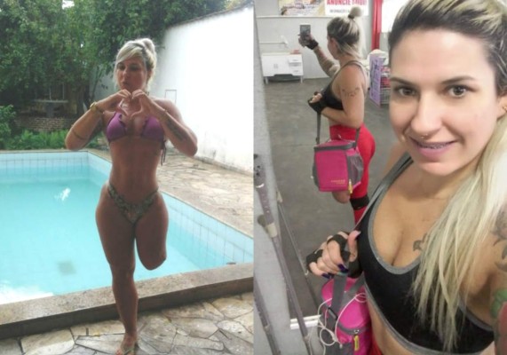 Miss Bumbum tiene su primera candidata discapacitada  