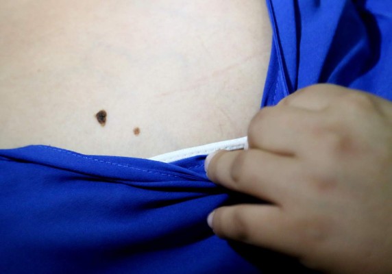 Pretenden beneficiar a más de 700 personas con campaña lunar