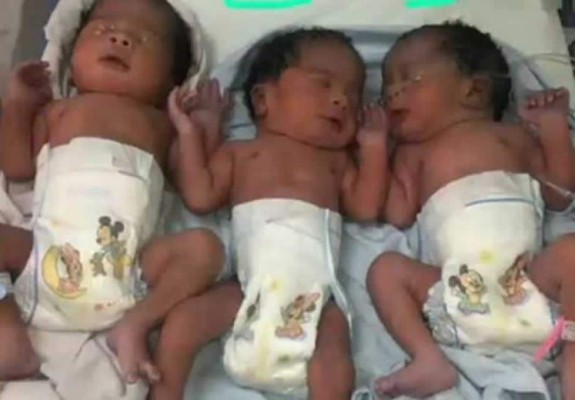 Nacen trillizos en el Hospital Mario Catarino Rivas de San Pedro Sula