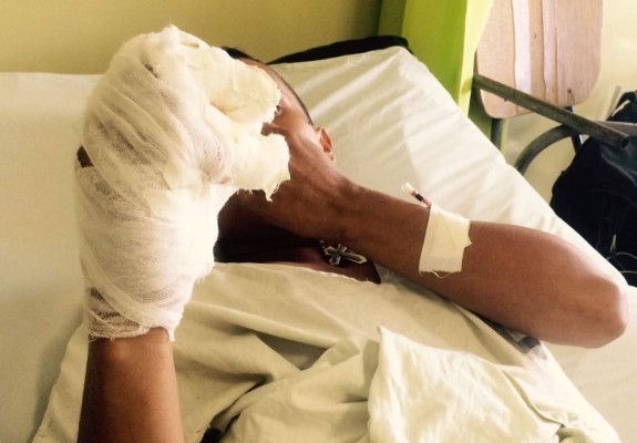 'Quemarse con pólvora es lo más terrible que le puede pasar a uno'