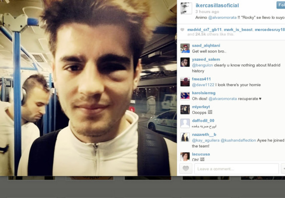 Foto: Así quedó el ojo de Morata tras un golpe fortuito