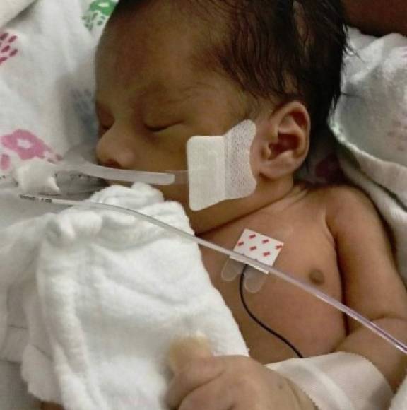 El pequeño Yovanny Yadiel, fue ingresado en condición crítica en el hospital Advocate Christ Medical Center de Chicago, tras ser arrancado del vientre de su madre, luego de que esta fuera asesinada por dos mujeres que intentaron robarle a la criatura.