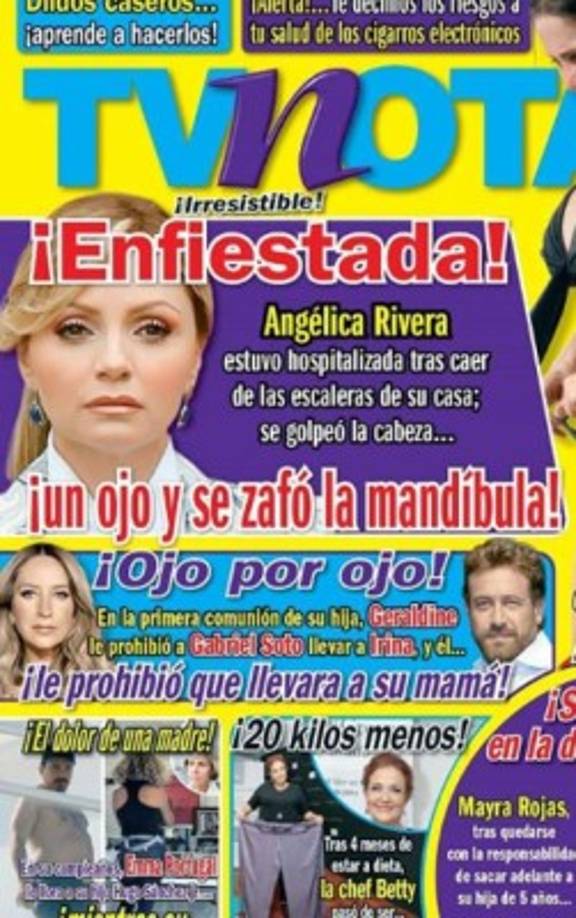 Tv Notas reportó que la exprimera dama de México se cayó, se golpeó la cabeza y se zafó la mandíbula por lo que tuvo que ser hospitalizada.