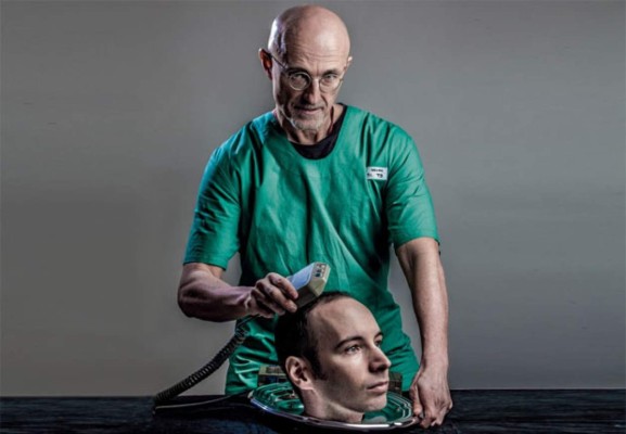 ​Primer transplante de cabeza será en el 2017   
