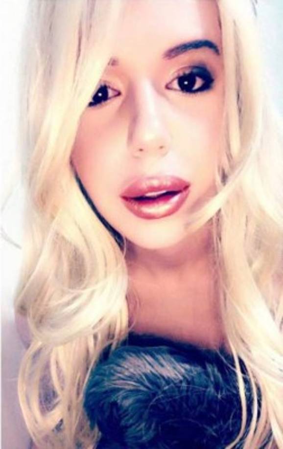 Bryan asegura que gasta al mes 500 dólares en cremas para el cuidado de su piel.