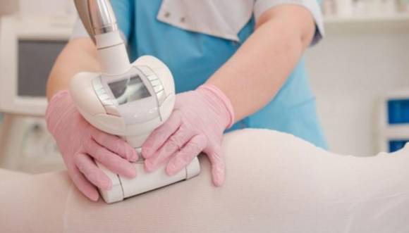 La celulitis otoñal aparece tras los excesos del verano.