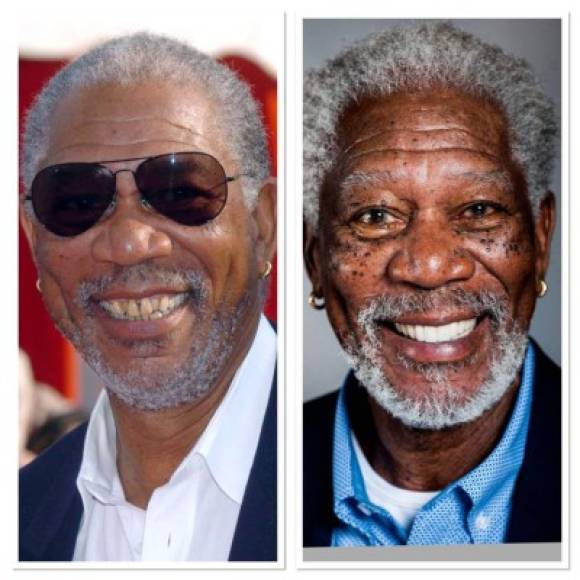 Morgan Freeman.<br/>El actor dejó atrás aquellos dientes chuecos, incluso algunos encima de otros, y amarillos por unos de tamaño igual y mucho más blancos. Tal parece que su sonrisa perfecta fuera el reflejo de una sólida trayectoria artística en la actuación.<br/>