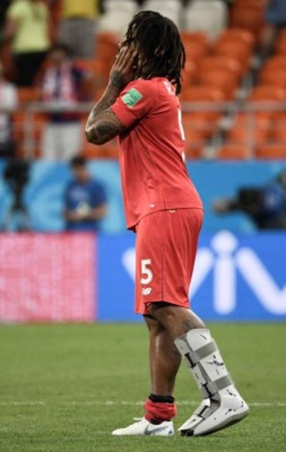 El capitán Román Torres tuvo que usar una prótesis.