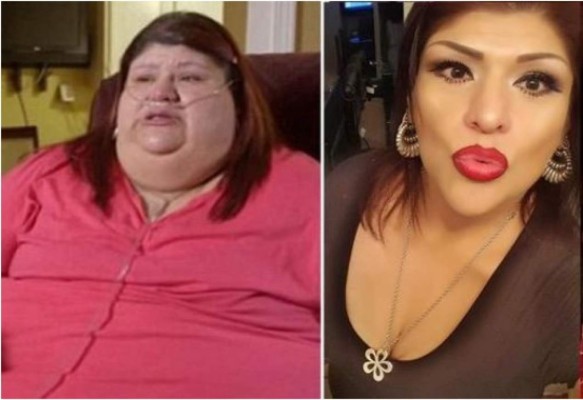 Mujeres que le ganaron a la obesidad
