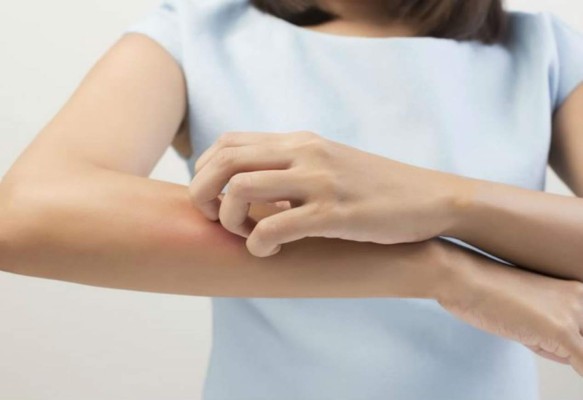 Identifican el mecanismo del cerebro que provoca a las personas a rascarse