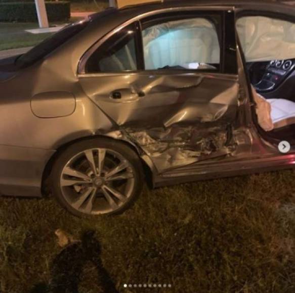 Recientemente tuvo un accidente en donde estrelló su vehículo, para fortuna solo resultó con pequeñas fracturas.