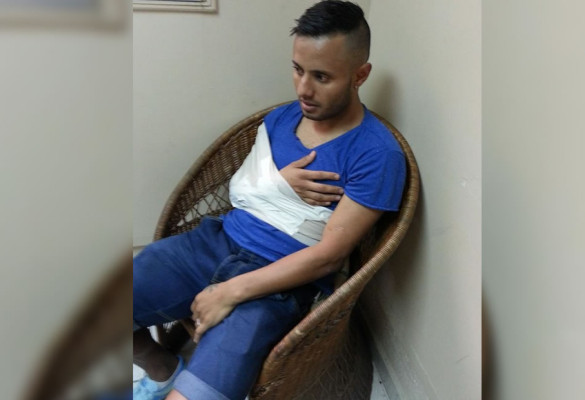 Allan Alemán, baja un mes en el Real España