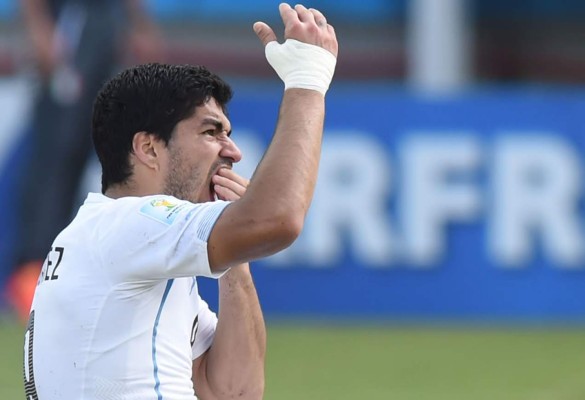 Suárez tiene hasta la 2:00 pm para defenderse por mordida