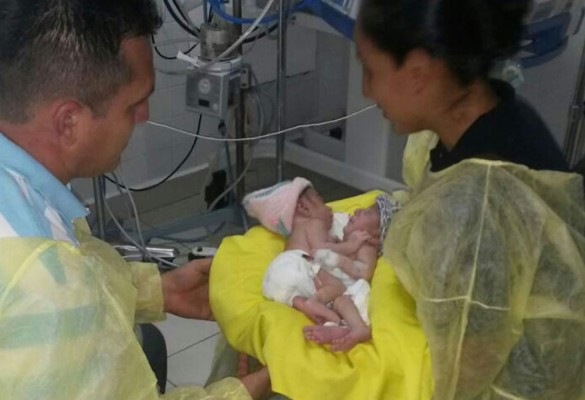 Madre de siamesas: 'Ayúdenme a salvar la vida de mis hijas”