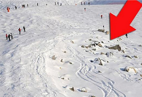 La vida de Schumacher corre peligro por 'lesiones cerebreales serias'