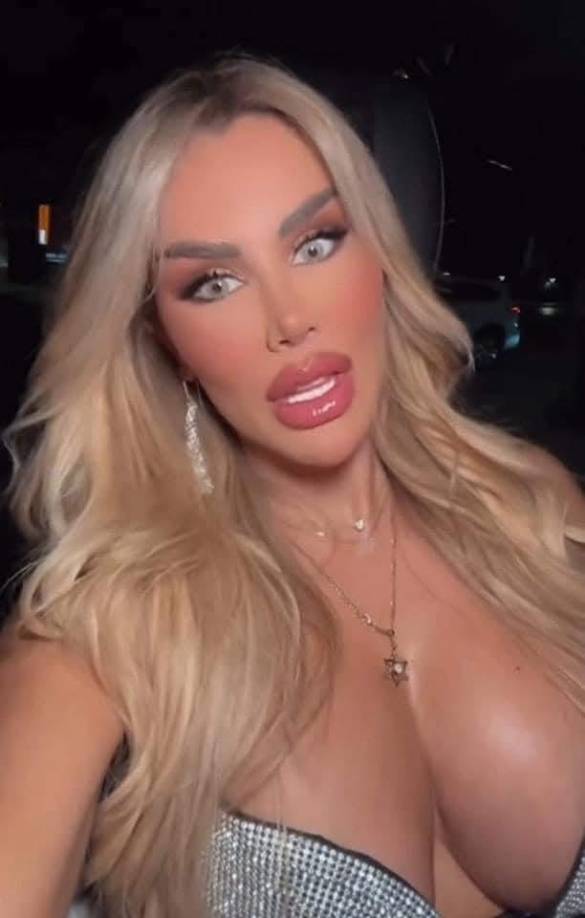 A sus 48 años, Conde se ha realizado múltiples tratamientos estéticos. Durante la década de 2010, Ninel Conde optó por procedimientos más notorios como liposucciones, aumento de senos y glúteos, además de perfilado facial.