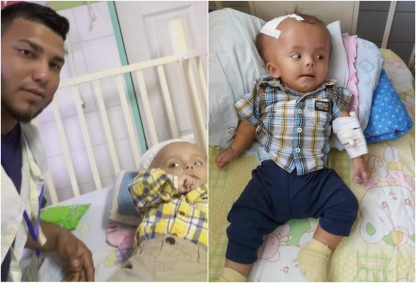 Padre pide ayuda en Facebook para su bebé con hidrocefalia