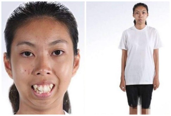 Ganó un concurso de cirugías, y el cambio de su rostro es increíble