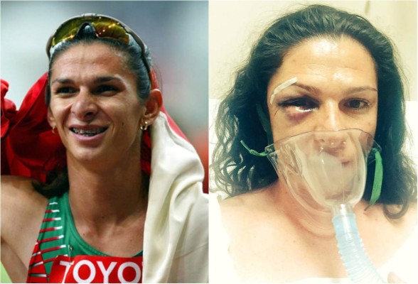 Dan golpiza a senadora mexicana Ana Gabriela Guevara