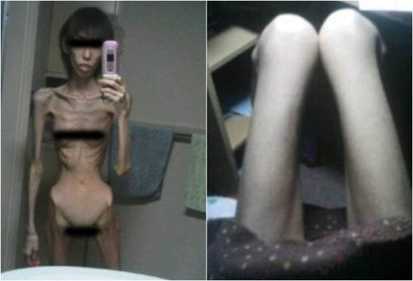 Joven relata el horror que vivió al ser torturada por su abuelo